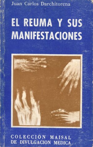 El Reuma y sus manifestaciones